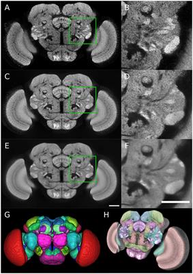 A Statistically Representative Atlas for Mapping Neuronal Circuits in the Drosophila Adult Brain